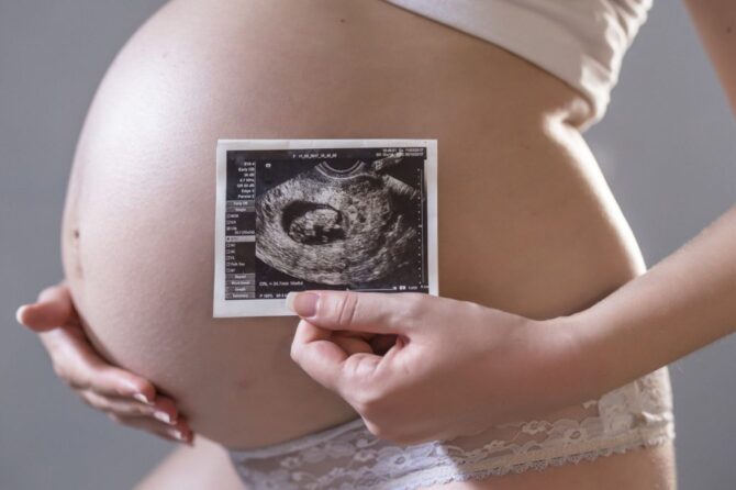 What to Expect from an Early Pregnancy Scan: A Guide for Expectant Parents